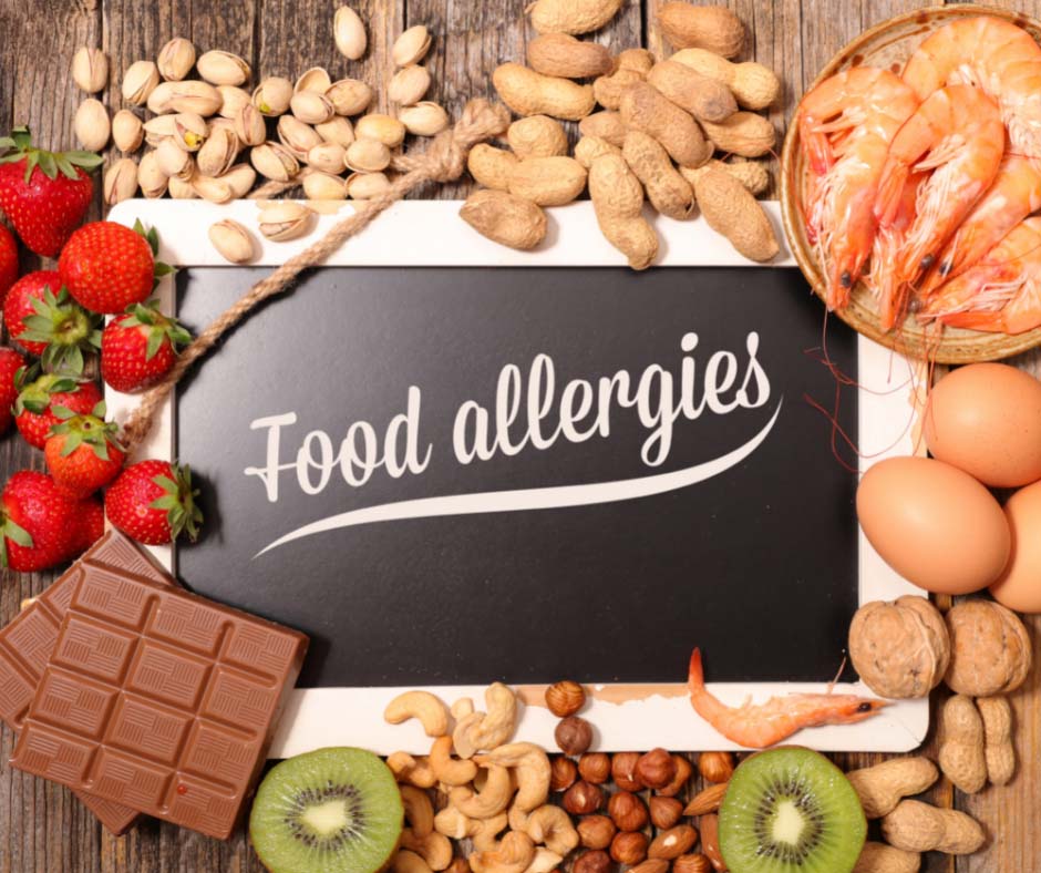 Catering to food allergies